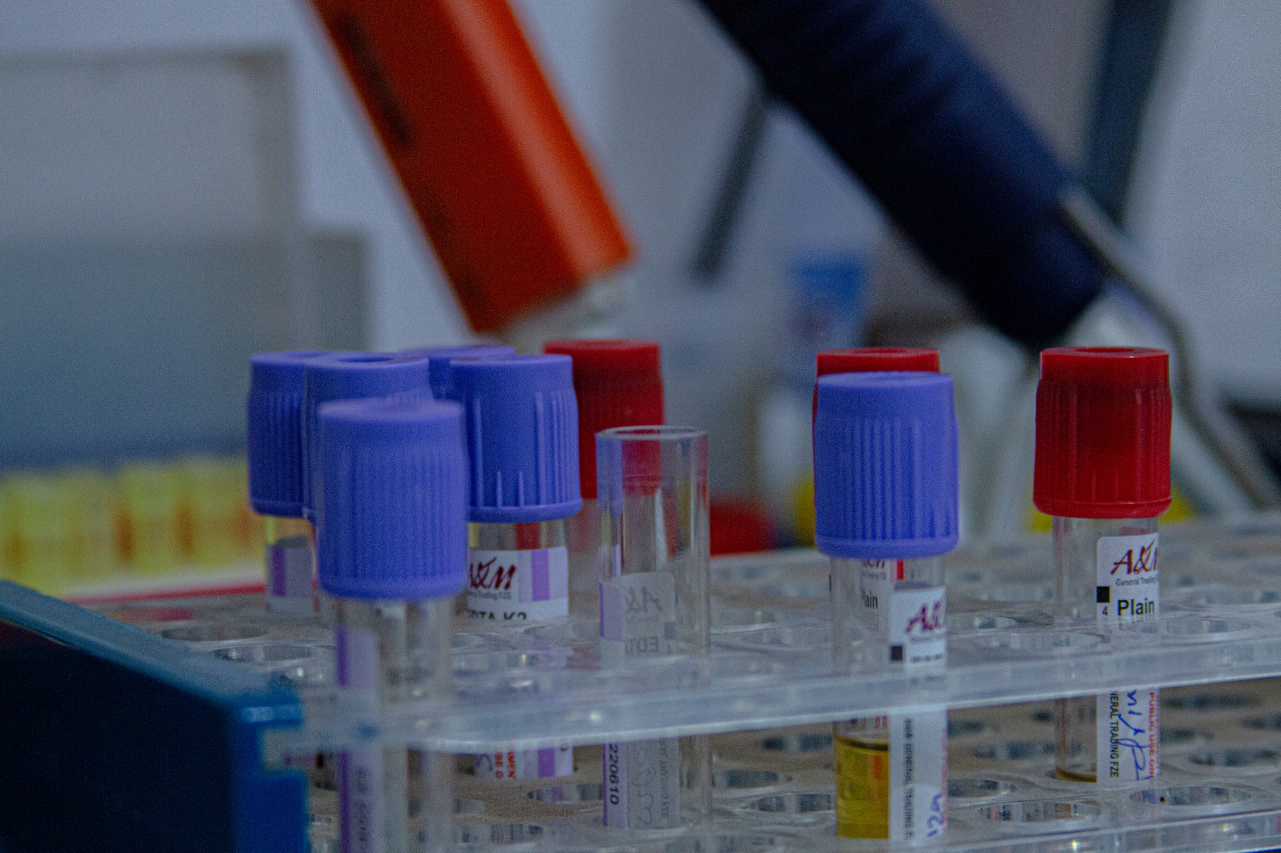 Colour-coded blood collection tubes in a rack